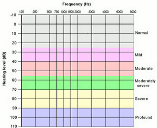 dB HL - Sensitivity to Sound - Clinical Audiograms | Auditory Neuroscience