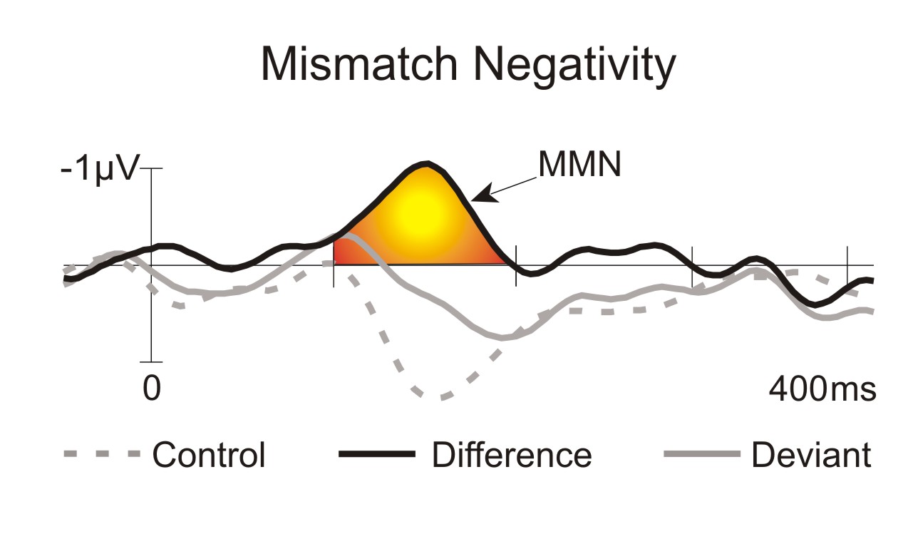 Below examples. Mismatch negativity. Mismatch negativity р300. Session mismatch. Негативная реакция несовпадения (mismatch negativity).