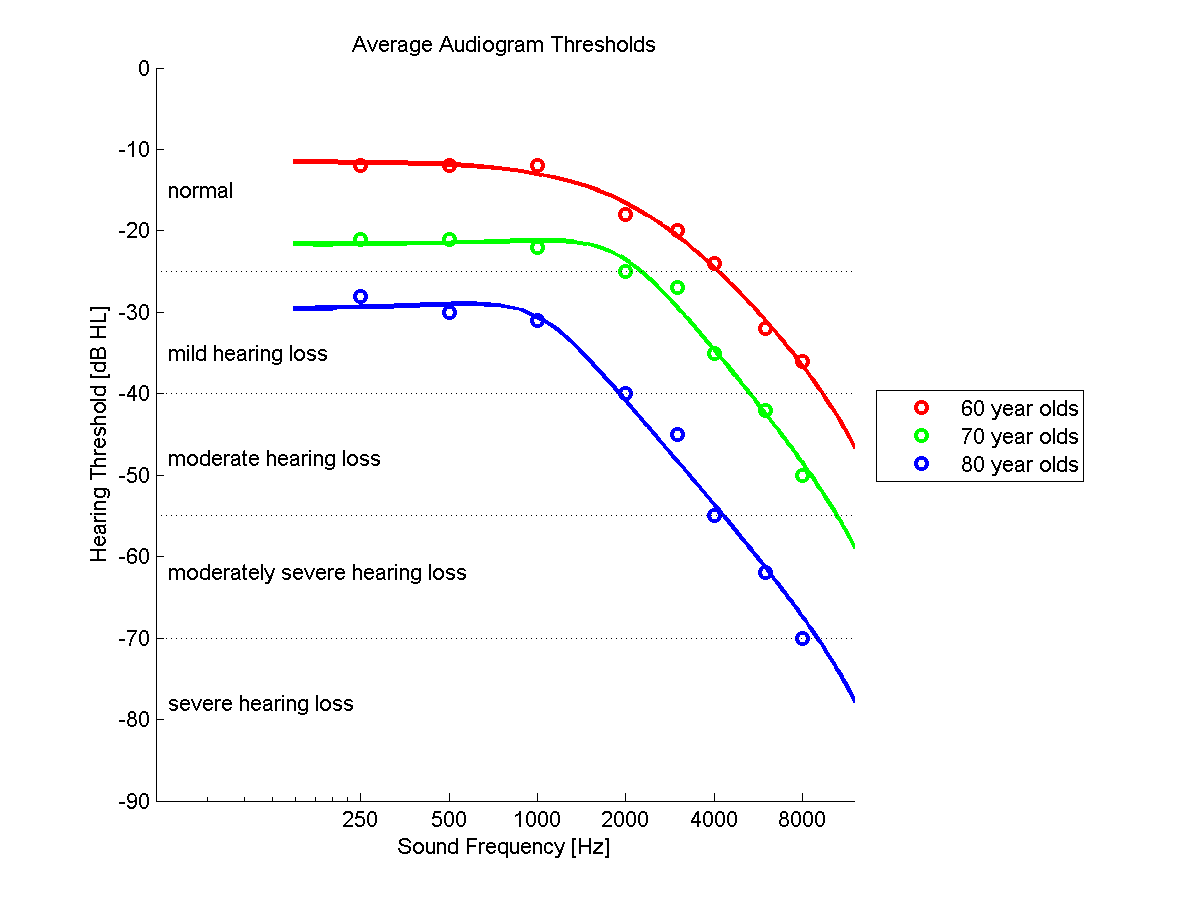 average hearing loss graph